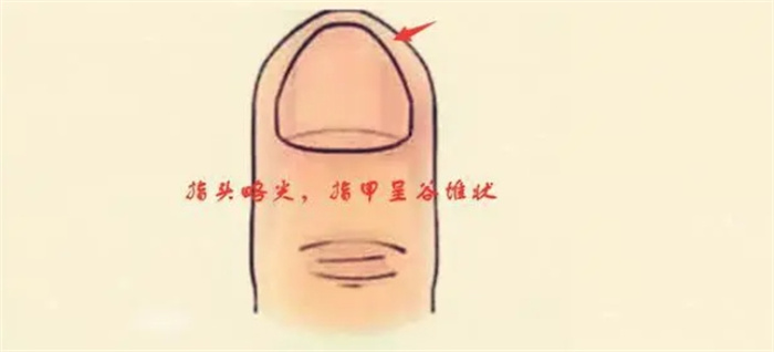 һָǬָ״Ǹ־ʲô