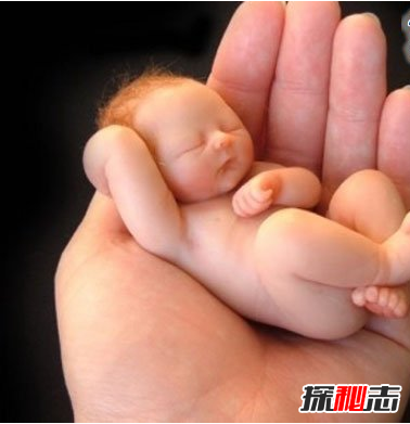 世界上最小的婴儿阿米利娅泰勒,仅280克(现状)