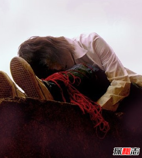 最恐怖的40种怪病,英国8岁少女患睡美人症(身体一夜神秘瘫痪)
