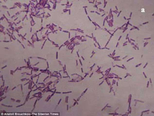 将活了3千5百万年的“永生细菌”注入人体内将会怎样？