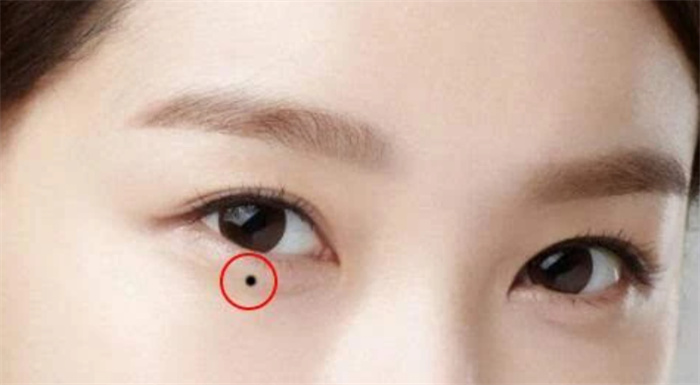 女人身上的四颗离婚痣  情路坎坷  很难遇到真爱  感情容易被骗