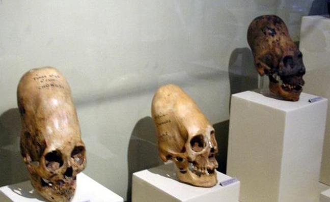 挪威发现大量的外星头骨，是不是可以证明外星人曾经到来？
