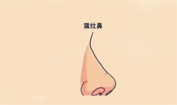 ֡©ơ࣬ʧܣҵѳɣһ