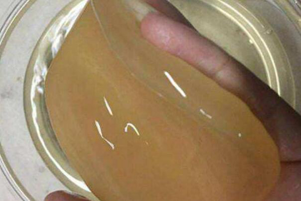 醋蛾子的危害有哪些 不影响身体（胶膜醋酸杆菌）(图1)