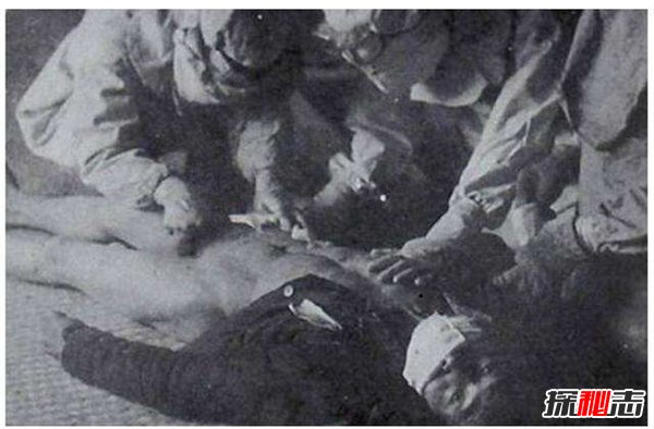 日本731部队的活体实验图片