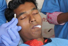 世界上最长的牙齿 长达3.67厘米(印度年轻男子)