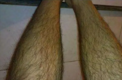 世界上最长的腿毛 长到了22.46厘米(杰森·艾伦)