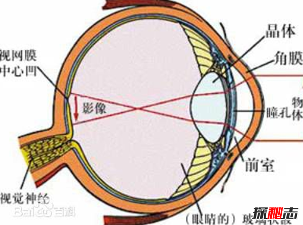 玩过山车会致严重眼病?武汉大学生玩过山车致视网膜脱落(患700度近视)