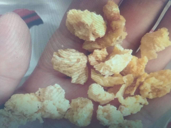 人胎盘到底能不能吃?吃胎盘真的有用吗(作用不大)(图7)