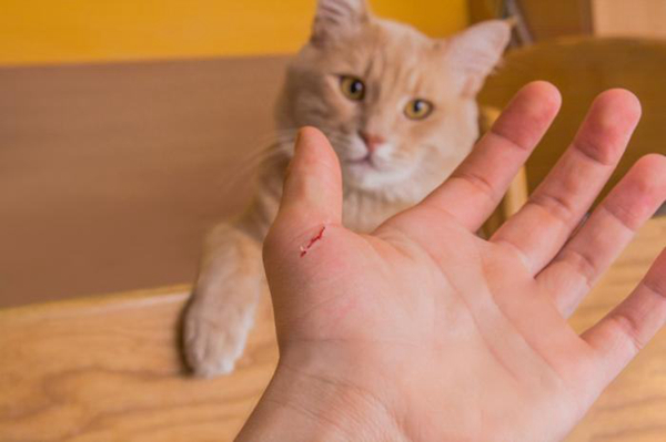 猫抓病是什么病?猫抓病会死吗（汉赛巴通体病毒引起）(图2)