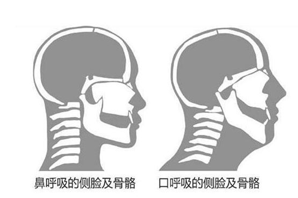 为什么用嘴巴呼吸不健康?易细菌感染血氧不足(影响颜值)(图7)