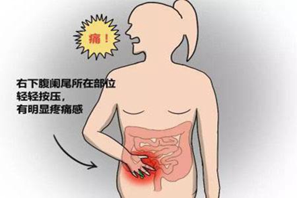盲肠和阑尾是一回事吗?阑尾是盲肠的末尾(盲肠不能割)(图4)