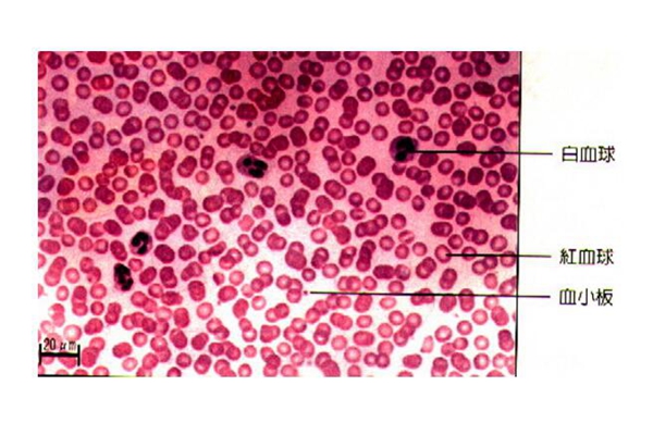红细胞叠连图片图片