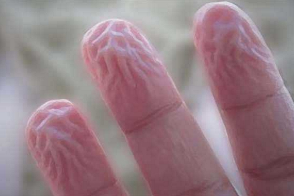 为什么洗澡时手会皱?手部皮下脂肪少(有利于抓握湿物)(图4)