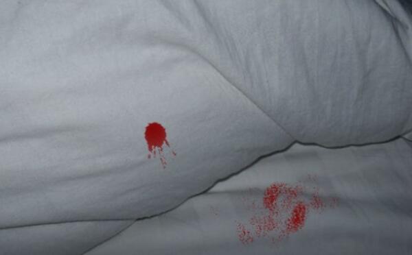 带血的床单落红图片