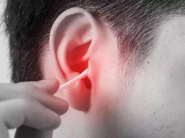 耳屎多是怎么回事?耳屎突然增多是癌症吗(图3)