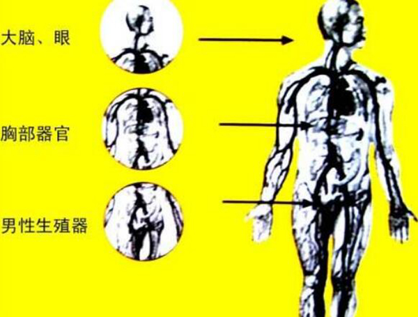 辐射病是什么病?有哪些症状证明被辐射了(图1)