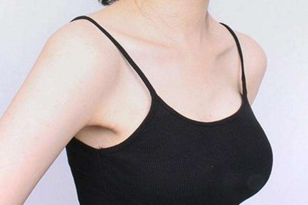 20岁女生胸下垂图片