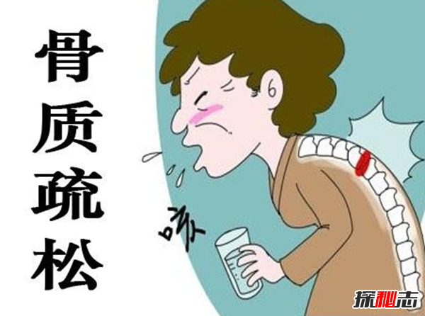 担心!20个残忍的遗传真相,父母会遗传给孩子的多种疾病(图12)