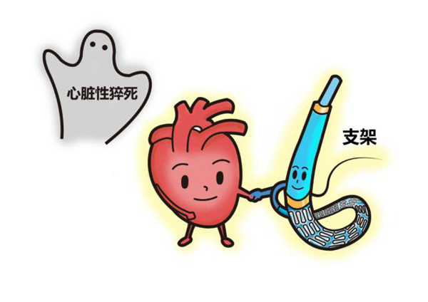 性猝死是什么原因?为什么会发生性猝死(图2)