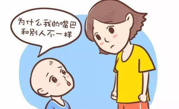 兔唇是什么原因造成的?婴儿兔唇应该怎么办(图1)