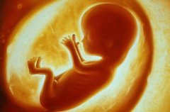 在孕妇的体内发现微型塑料，这是怎么回事？（人体塑料）