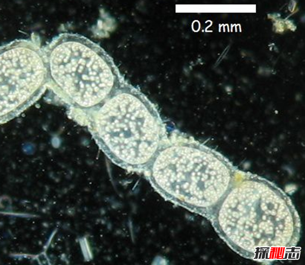 细菌最大有多大?世界上最大的细菌(附图片)