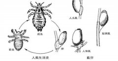 二十多年前频繁地出现在人类身上 如今几乎很难找到（虱子）