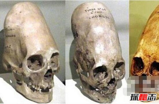 人工將頭部拉長(改變頭型增強大腦)古印第安人長頭謎